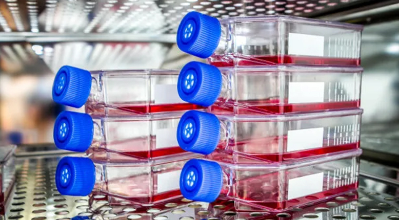 Recombinant protein production in mammalian cell culture expression